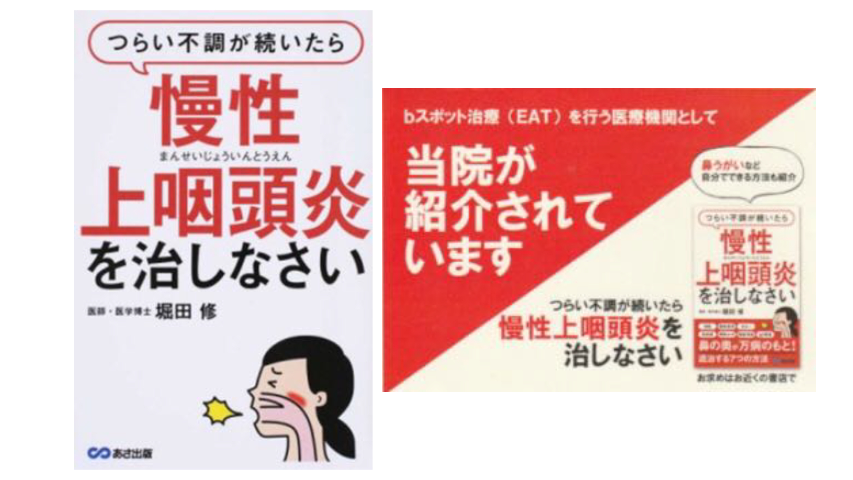 つらい不調が続いたら、慢性上咽頭炎を治しましょう