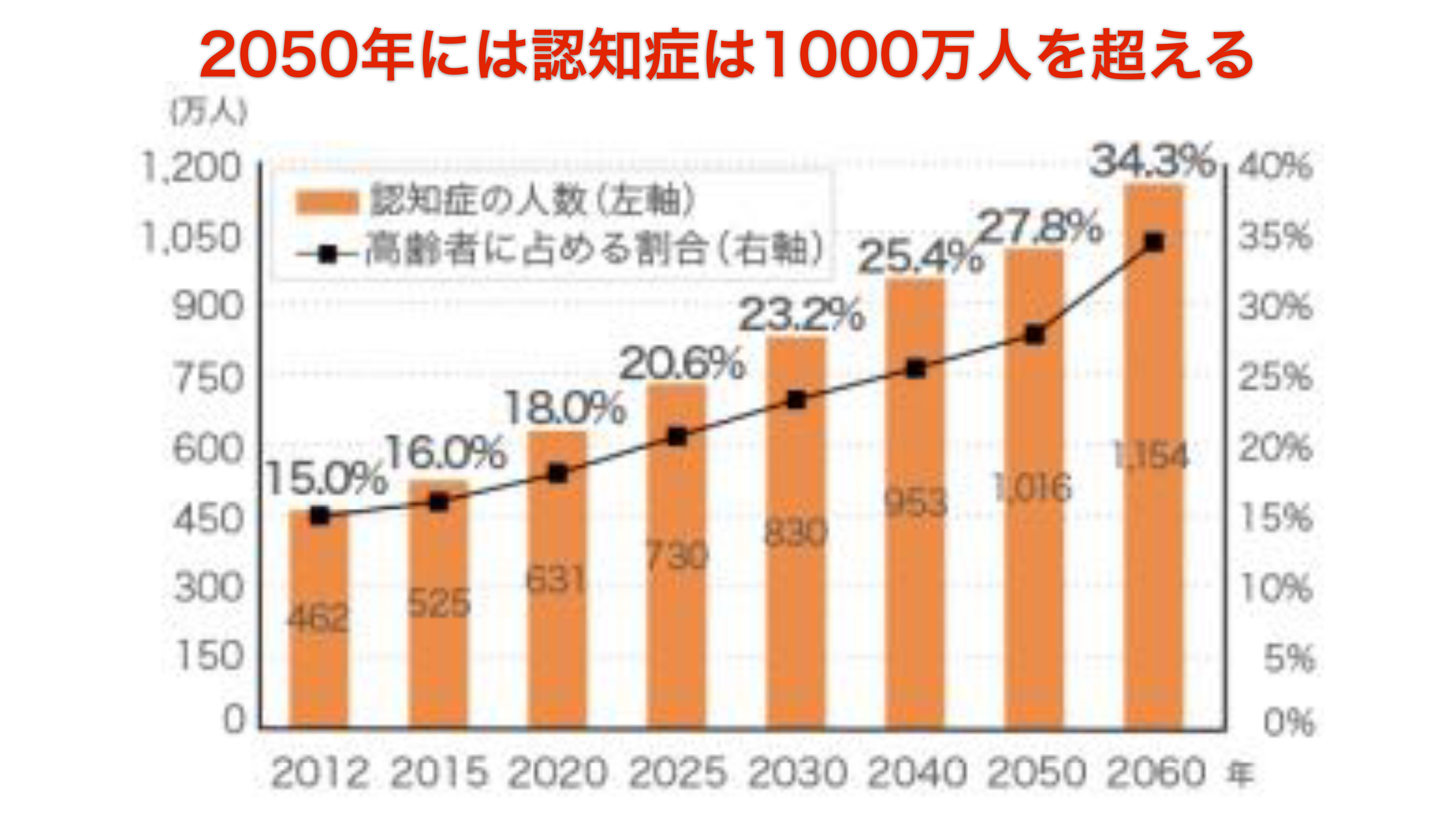 補聴器で認知症の予防を行いましょう